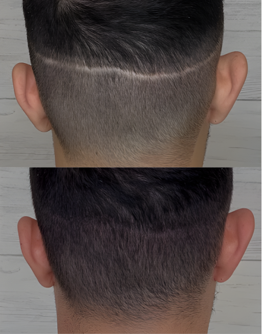 Before and After Result 2
