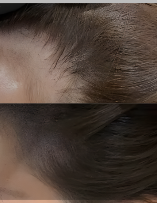 Before and After Result 3