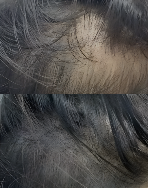 Before and After Result 4