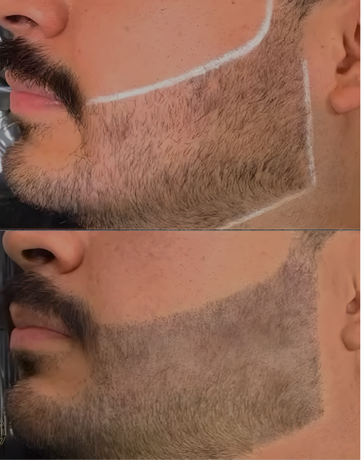 Before and After Result 5