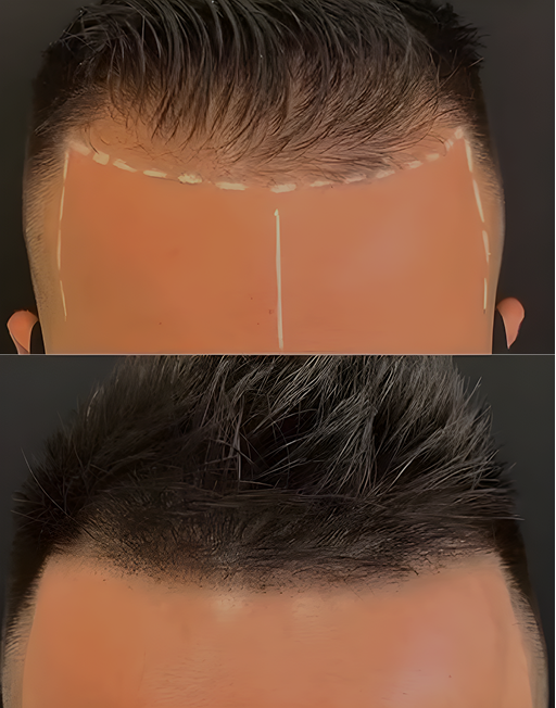 Before and After Result 1