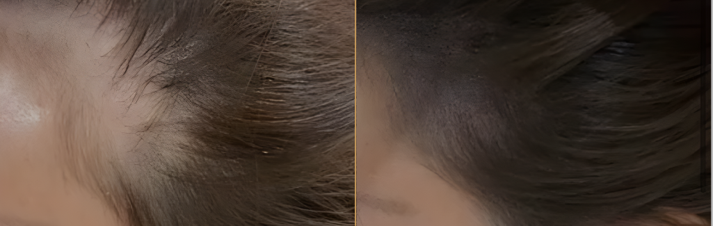 Before and After Result 3