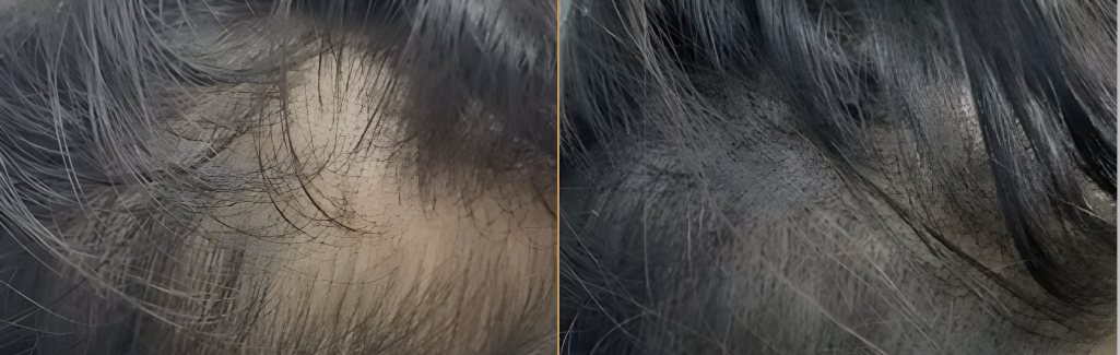 Before and After Result 4