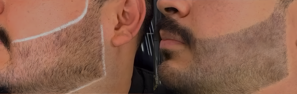 Before and After Result 5